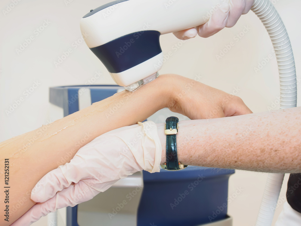 Fototapeta premium Laser hair arm removal epilation. Treatment in cosmetic salon.