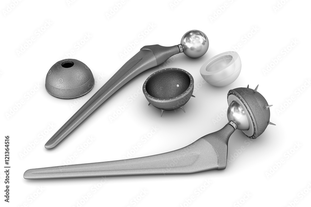 Hip replacement implant isolated on white. Medically accurate 3D