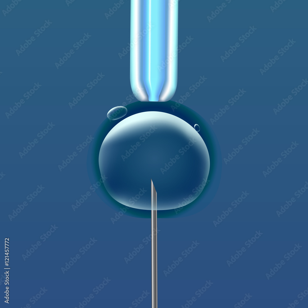 In vitro fertilization IVF , the egg ovum , pipette and pipe vertical