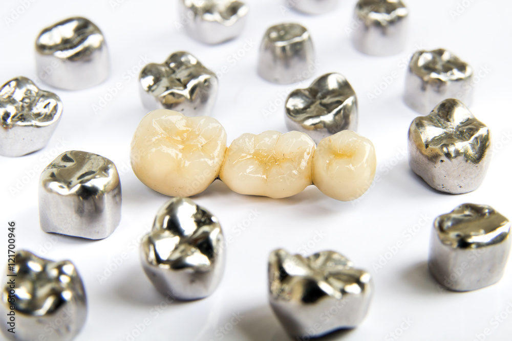 Dental ceramic, gold and metal tooth crowns on white background. Isolated. Dental ceramic, gold and metal tooth crowns on white background. Isolated.