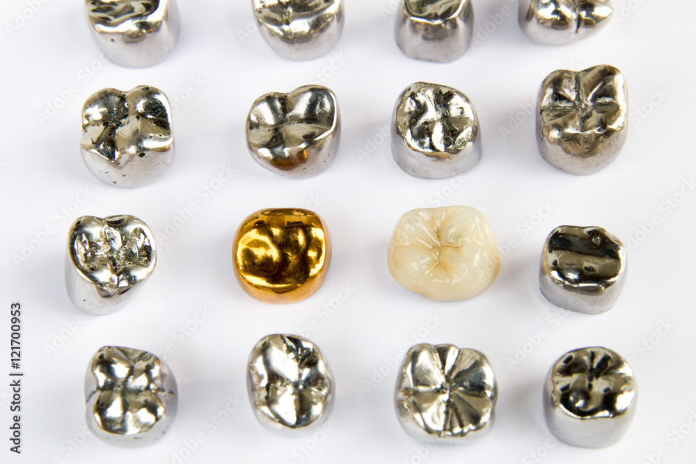 Dental ceramic, gold and metal tooth crowns on white background. Isolated. Dental ceramic, gold and metal tooth crowns on white background. Isolated.