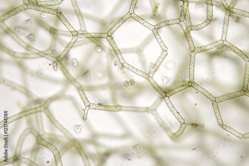 Freshwater Vorticella campanula on Hydrodictyon reticulatum. Aquaculture photo