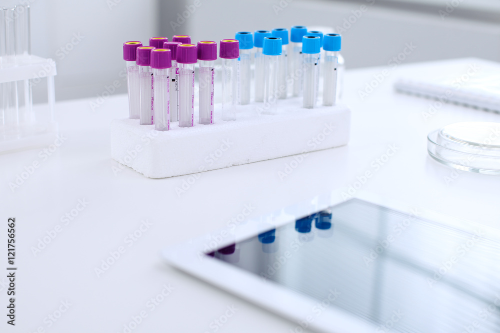 Research laboratory working space. Test tubes and tablet PC are lying at the table. Medical equipment. Blood test