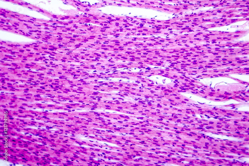 Photography Heart muscle, light micrograph