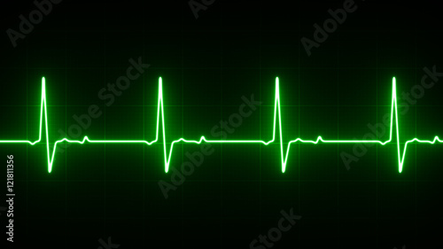 Schilderij op canvas EKG Heart Line