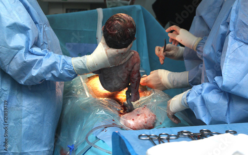 birth