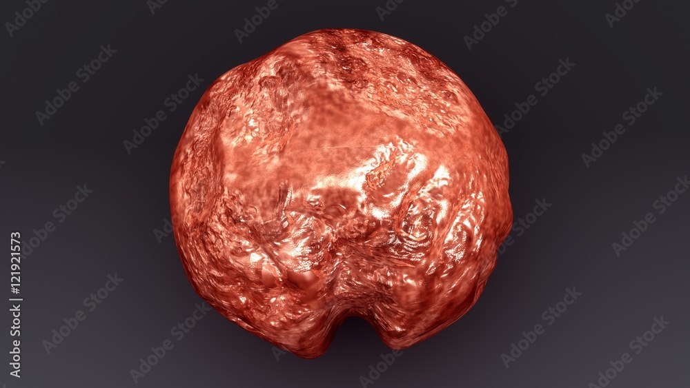 Granuloma Granuloma