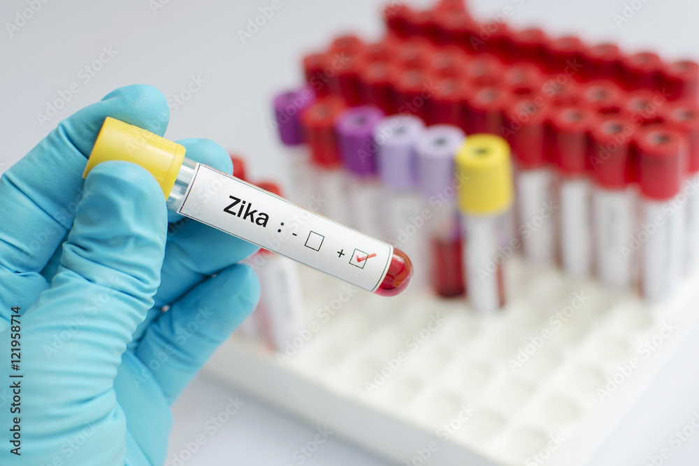 Fototapeta premium Blood sample positive with Zika virus