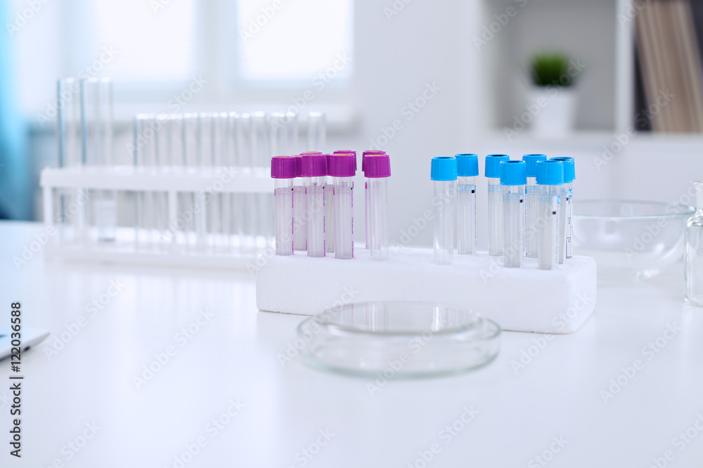 Research laboratory working space. Test tubes and tablet PC are lying at the table. Medical equipment. Blood test Research laboratory working space. Test tubes and tablet PC are lying at the table. Medical equipment. Blood test