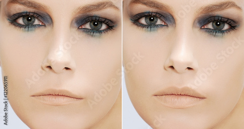 woman fill lips - before and after