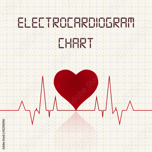 Electrocardiogram (ECG) chart table - healthcare infographic