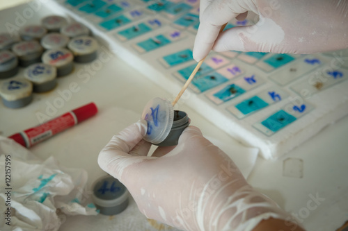 Stool analysis Stool examination Stool test