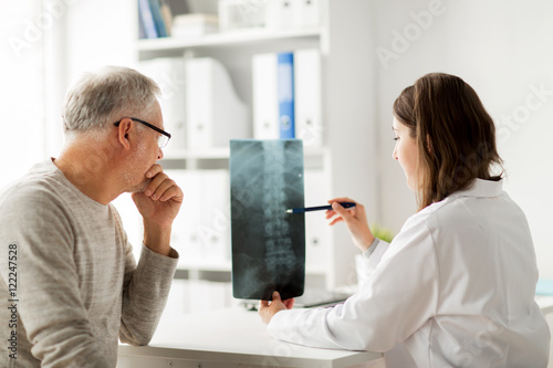 Foto doctor with spine x-ray and senior man at hospital