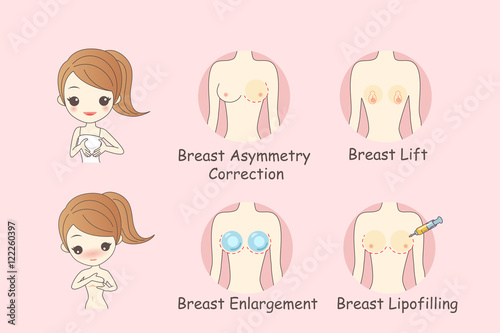 cartoon woman chest plastic surgery