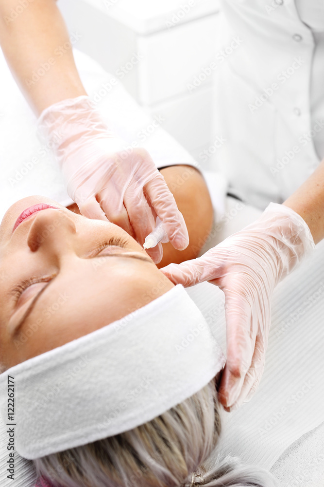 Mezoterapia igłowa, kosmetyczka nakłuwa twarz kobiety. - obrazy, fototapety, plakaty 
