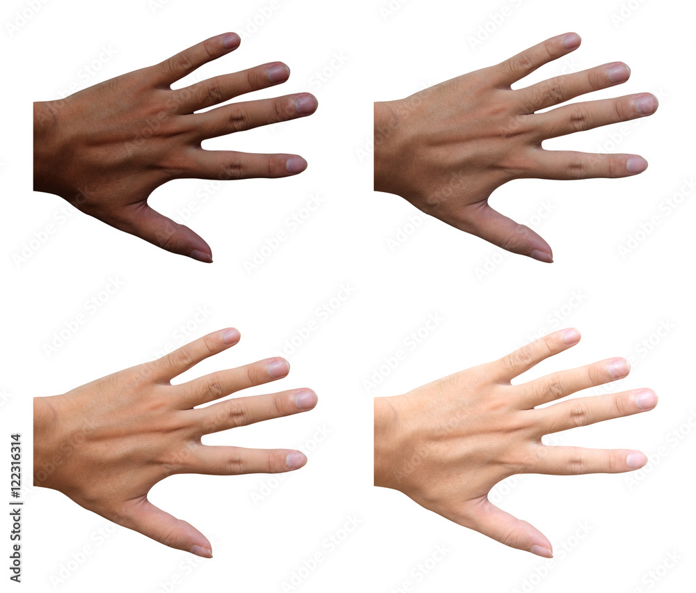 dark skin turn to white skin, whitening , 4 steps of uv protection , hand  Stock Photo | Adobe Stock