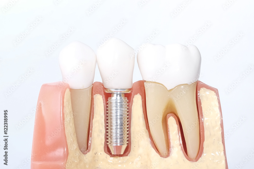 Obraz premium Generic dental teeth model