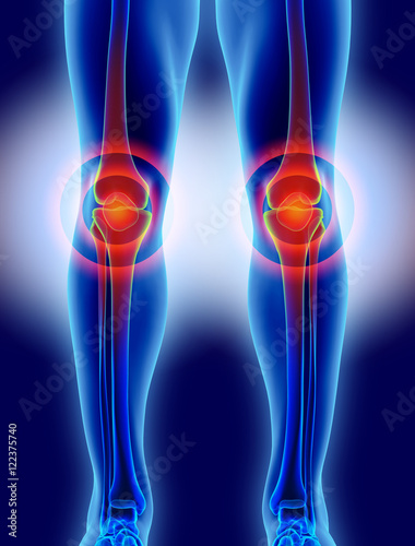 Knee painful - skeleton x-ray.