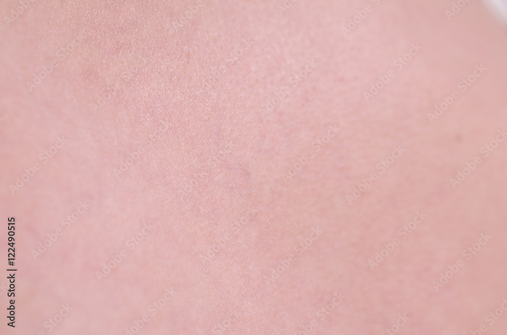 Fototapeta premium Blood vessels on woman leg, closeup.