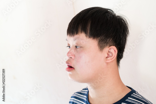 Portrait of Down Syndrome boy