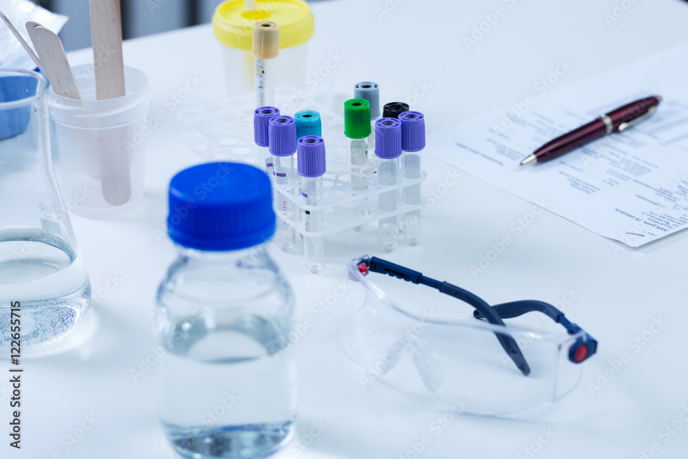analysis laboratory equipment on the table analysis laboratory equipment on the table
