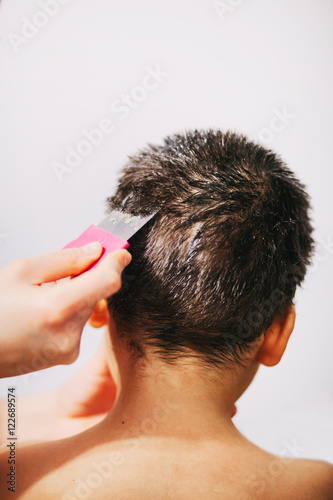  Removing lice and nits from the hair