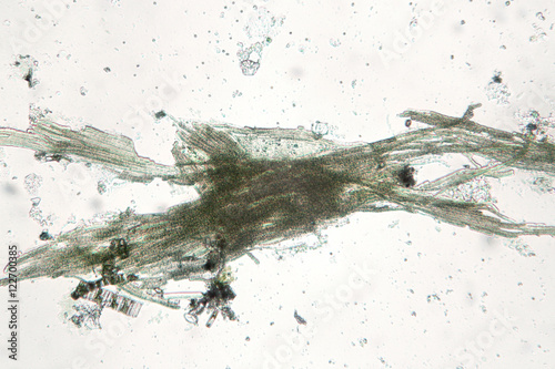 Freshwater cyanobacteria Aphanizomenon by microscope. Green water cause. The sample is pressed with a cover glass