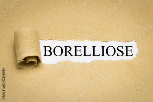 Borelliose