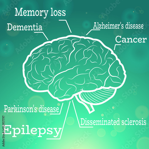 Human Brain Neurology Diseases Anatomical Conception Vector Illustration