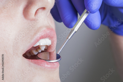 Nahaufnahme Mund beim Zahnarzt photo