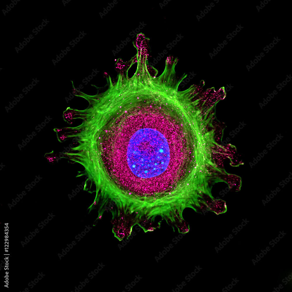 Immunofluorescence of single human cell stained grown in tissue culture