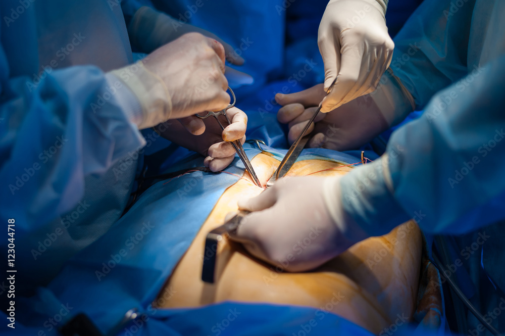 Operation using laparoscopic equipment Operation using laparoscopic equipment