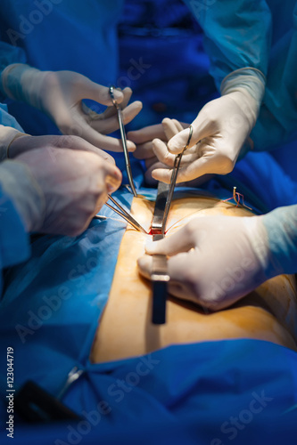 Operation using laparoscopic equipment