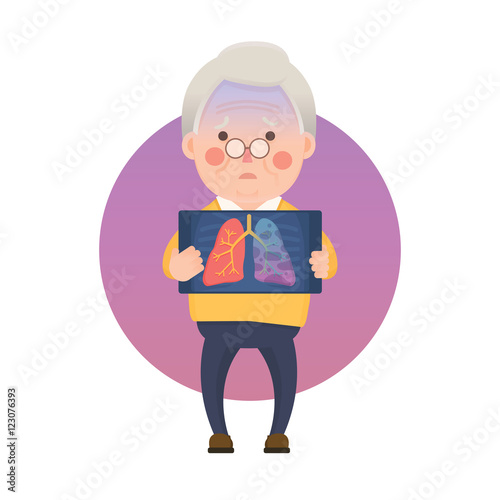 Vector Illustration of Old Man Holding X-ray Image Showing Lung Cancer Problem, Cartoon Character
