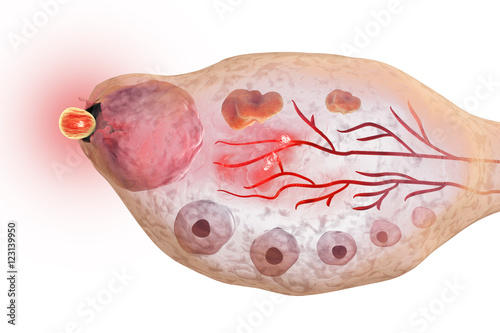 Ovulation in female ovary isolated on white background, 3D illustration. Ovarian follicules photo