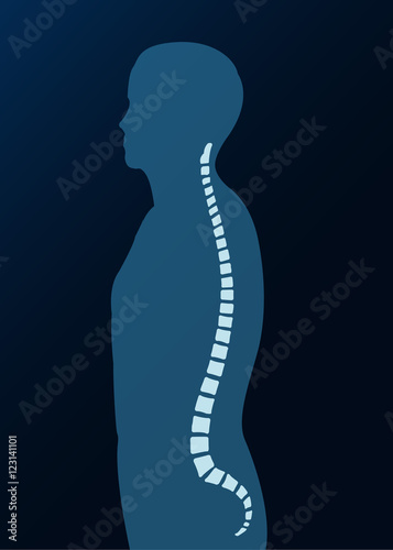 Wirbelsäule Röntgenbild Grafik Mensch Silhouette