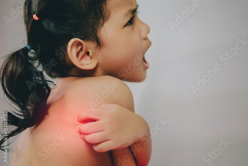 Health problem. asian young girl scratching her itchy back
