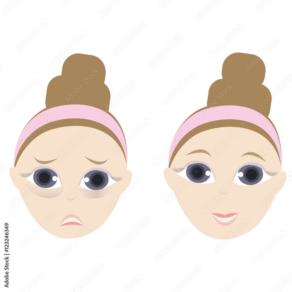 puffy eyes