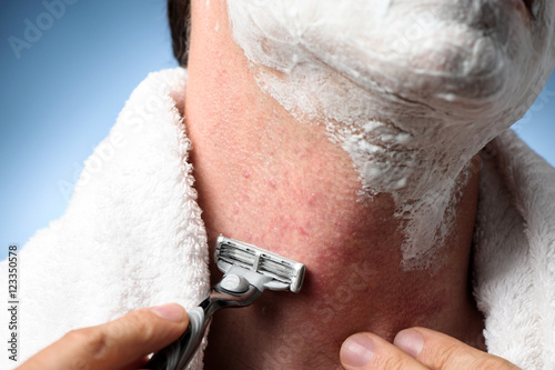 Closeup man shaving razor burn bumps and red rash