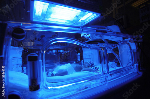 Newborn child baby having a treatment for jaundice under ultraviolet light in incubator. A neonatal intensive care unit (NICU), intensive care nursery (ICN) for premature newborn infants

 photo