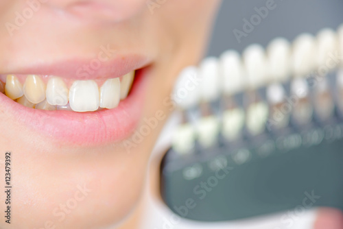 Lady smiling next to teeth samples