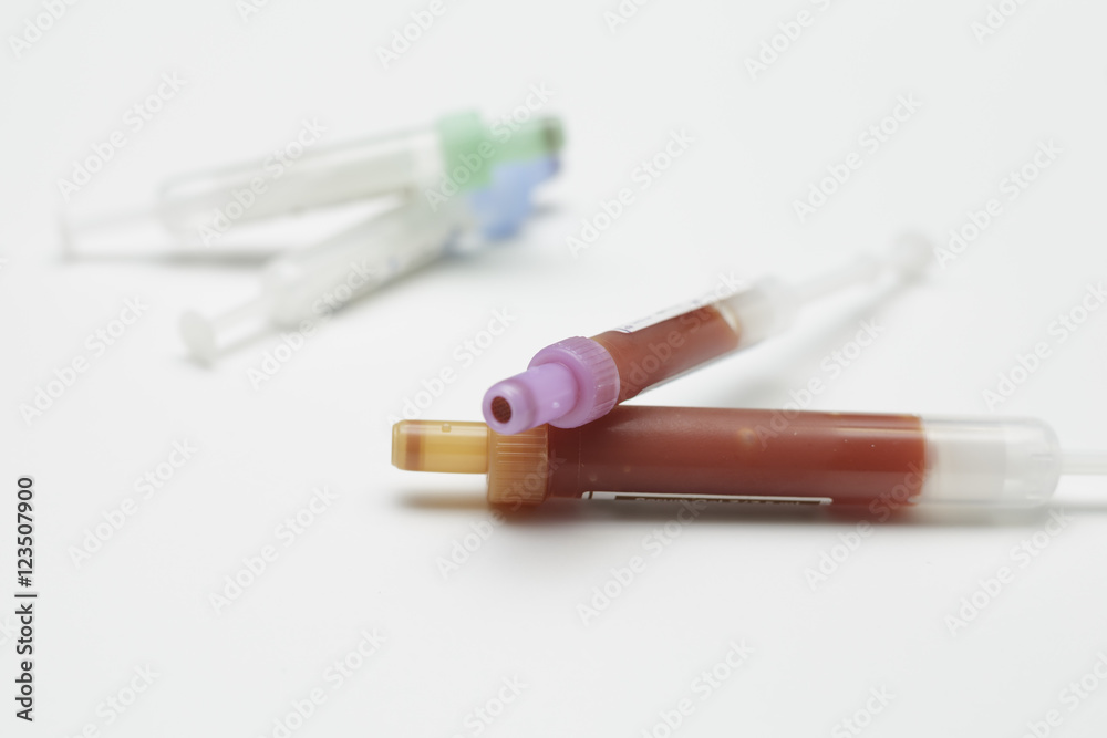 tubes full of blood for lab work tubes full of blood for lab work
