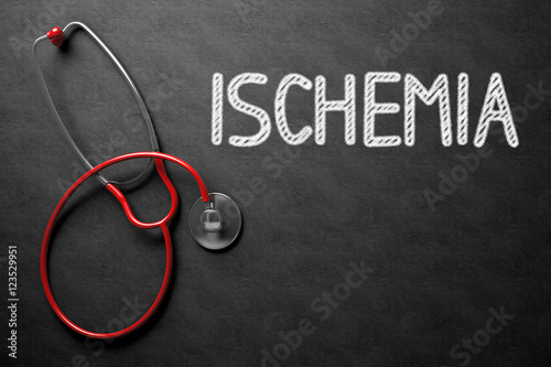 Photography Ischemia Concept on Chalkboard. 3D Illustration.