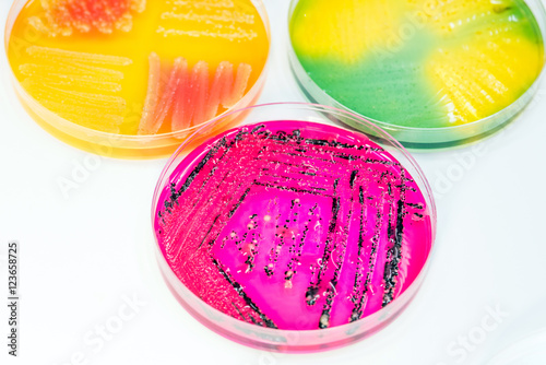 Bacterial colonies culture growth on selective agar media photo