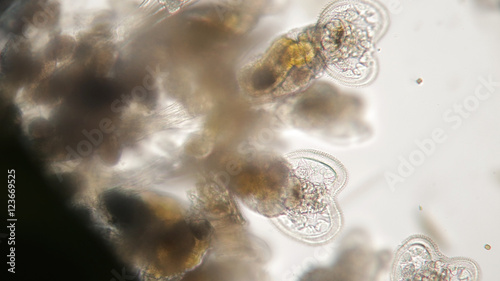 Canvastavla Pile of dried Arthropoda by microscope