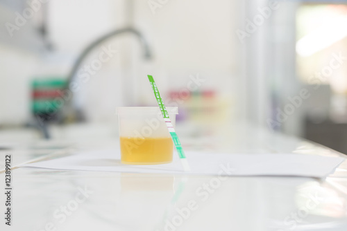normal yellow urine in laboratory testing.
