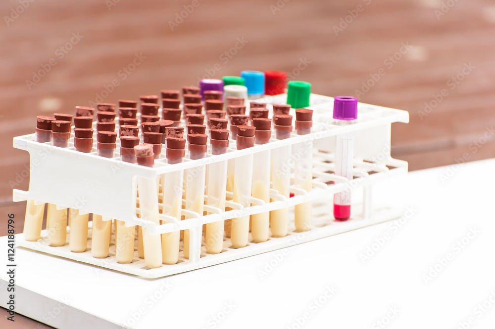 Scientist arrange samples for test in research lab Scientist arrange samples for test in research lab