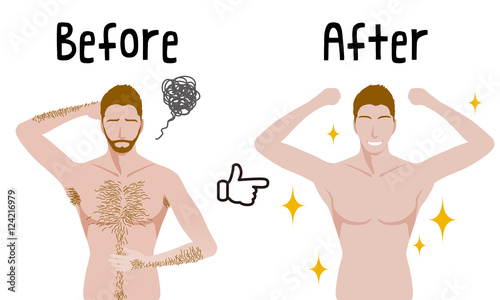 men's hair removal before after concept, unwanted hair, superfluous hair, vector illustration