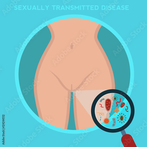 Sexually-transmitted diseases. woman body infected