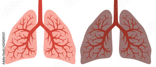 healthy and smokers lung before and after a lifetime of smoking